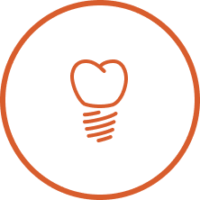 graphic of dental implants